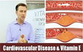 Coronary heart disease and Vitamin E