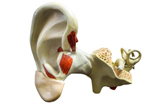 全球首例由3D打印的中耳移植手术已获成功