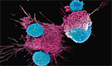 针对T细胞恶性肿瘤的 CAR-T细胞疗法临床研究
